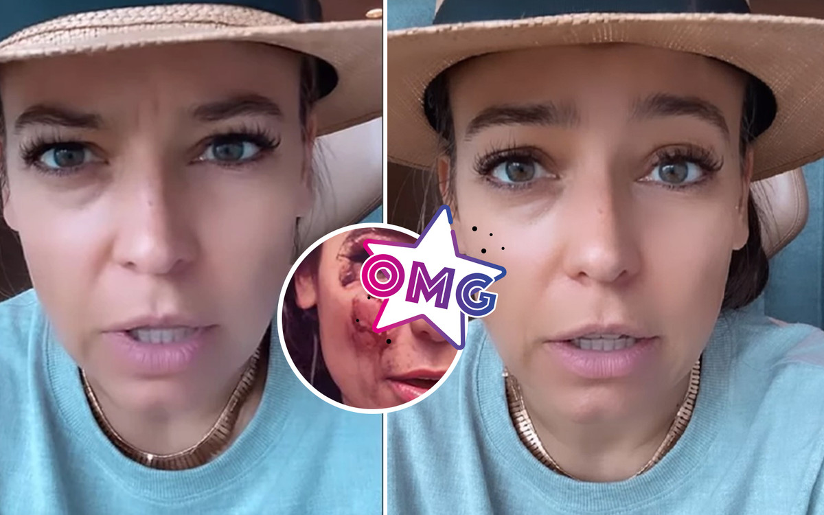 Anna Mucha padła ofiarą przestępstwa! To, co zrobili z jej twarzą woła o pomstę do nieba