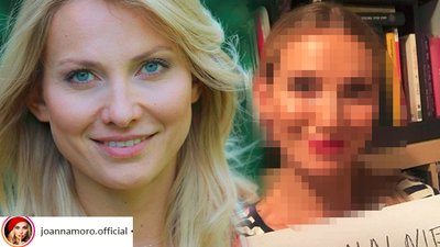 Joanna Moro przeszła operację PLASTYCZNĄ!