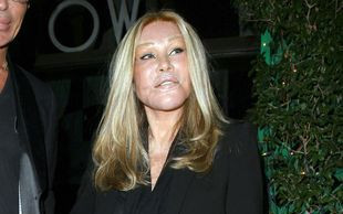 Ile na operacje wydała Jocelyn Wildenstein ? (FOTO)