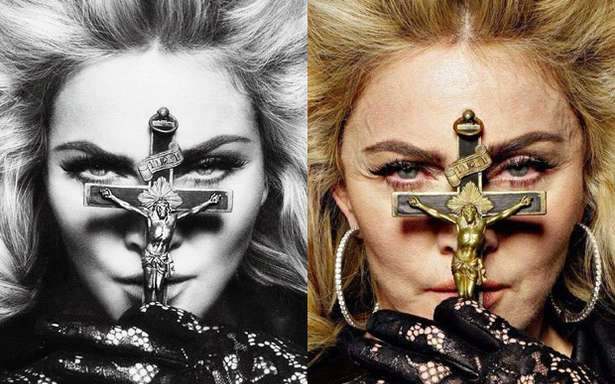 Madonna broni swojej nowej twarzy, “Padłam ofiarą ageizmu i mizoginii”