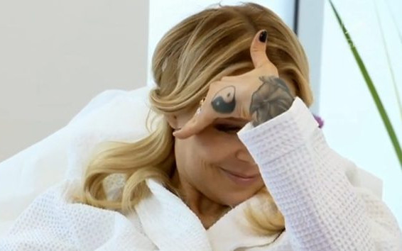 Maja Sablewska poddała się zabiegowi za 4,5 tys. złotych