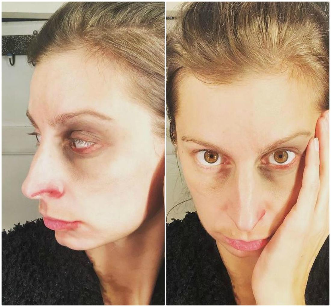 Magdalena Schejbal z posiniaczoną twarzą apeluje do fanów. Magdalena Schejbal z podbitym okiem apeluje do fanów.