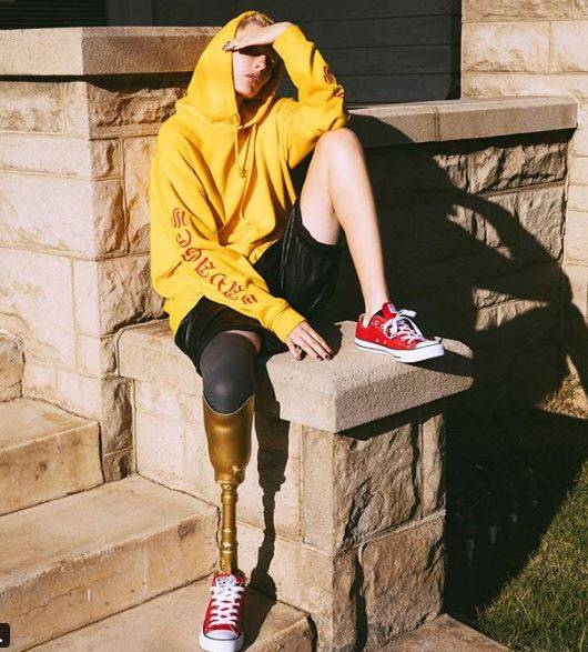 Modelka straciła nogę przez TAMPONY. Podzieliła się SZOKUJĄCYMI szczegółami