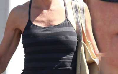 Tak starzeje się królowa operacji plastycznych (FOTO)