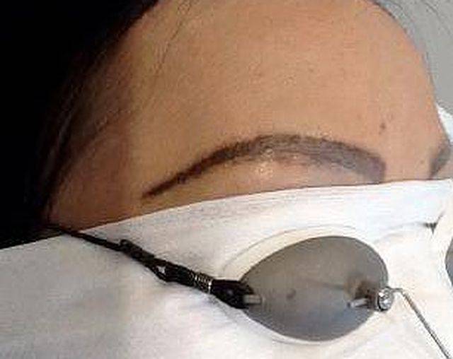 Uważaj na ten NIEBEZPIECZNY trend. Ta kobieta straciła przez niego brwi!