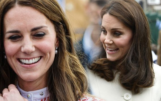 Kate w czasie ciąży ZMAGAŁA się z tą przypadłością