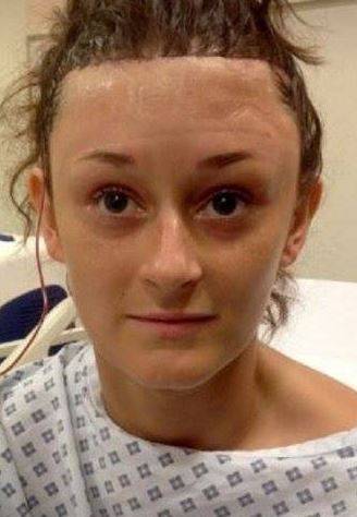 Ta operacja zmieniła jej życie. Wcześniej musiała ukrywać TO pod grzywką