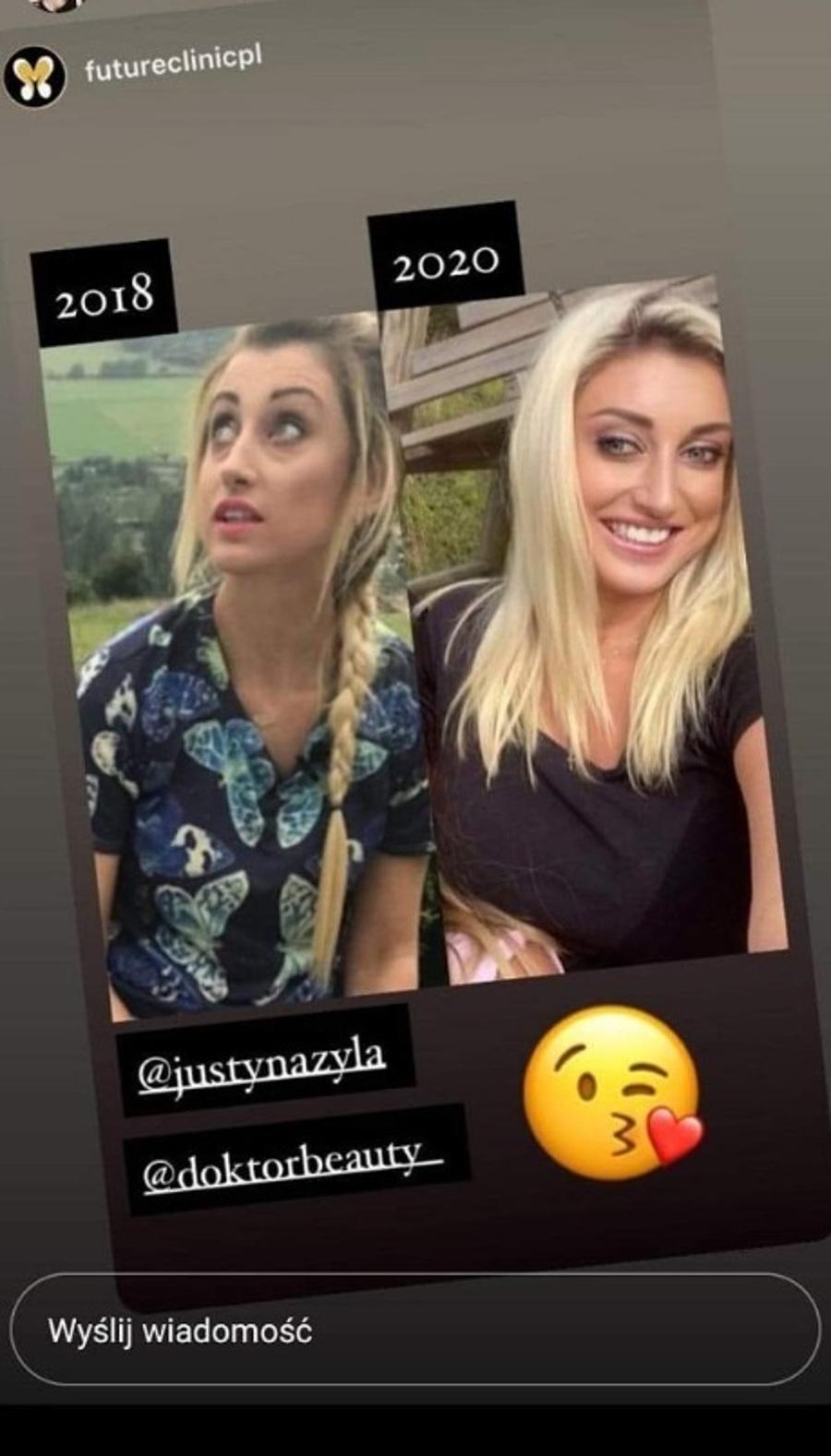 Metamorfoza Justyny Żyły. 