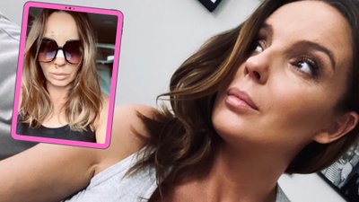 Agnieszka Włodarczyk trafiła do szpitala! Jej twarz nie wygląda dobrze