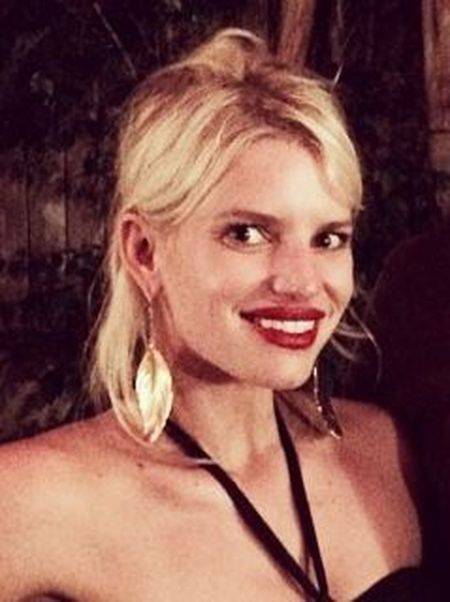 Gwiazdy podejrzewane o powiększenie ust