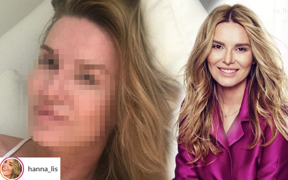 Hanna Lis leży bez makijażu. Internauci: Usta od specjalisty!