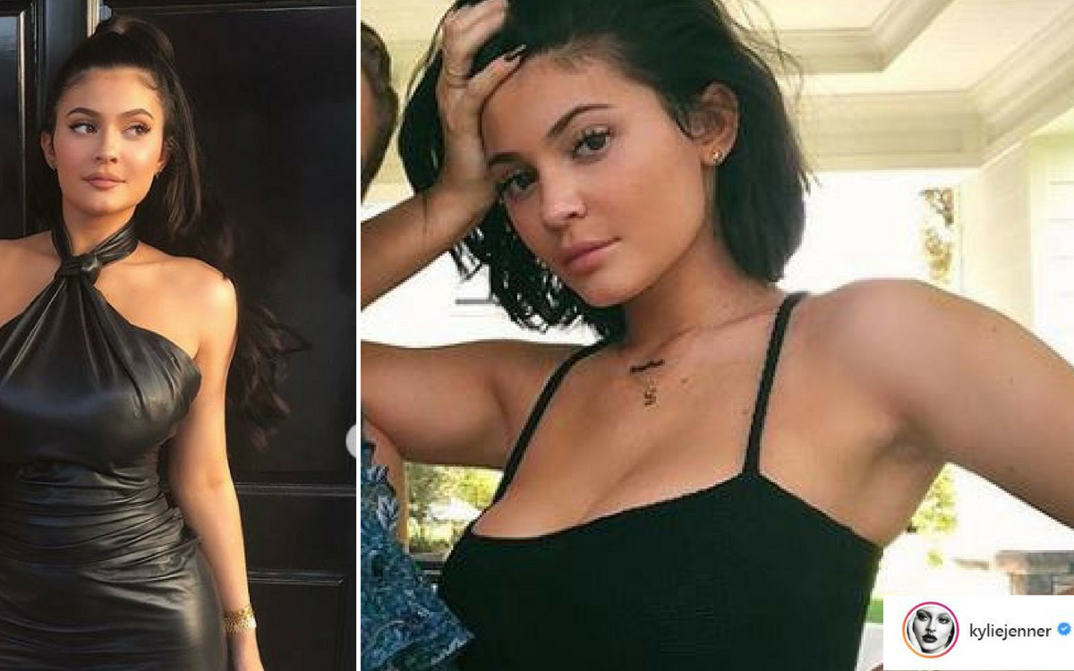 Kylie Jenner oficjalnie wypowiedziała się w sprawie usunięcia wypełniaczy UST!