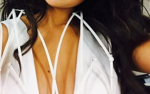 Czy pszczoła użądliła Selenę Gomez w usta? (FOTO)