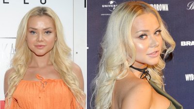 Ciupa odpowiedziała, czy obstrzykiwała BRODĘ i jak się zabezpiecza przez CIĄŻĄ