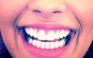 Co one widzą w wygolonych głowach? (FOTO)