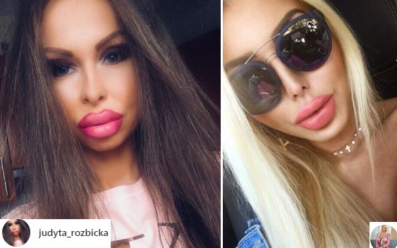 Poznajcie kolejną polską Instagramerkę, której usta są wielkości PONTONÓW