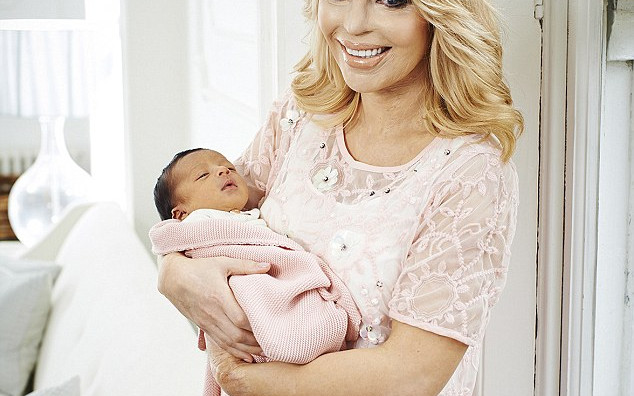 Katie Piper – modelka poparzona kwasem