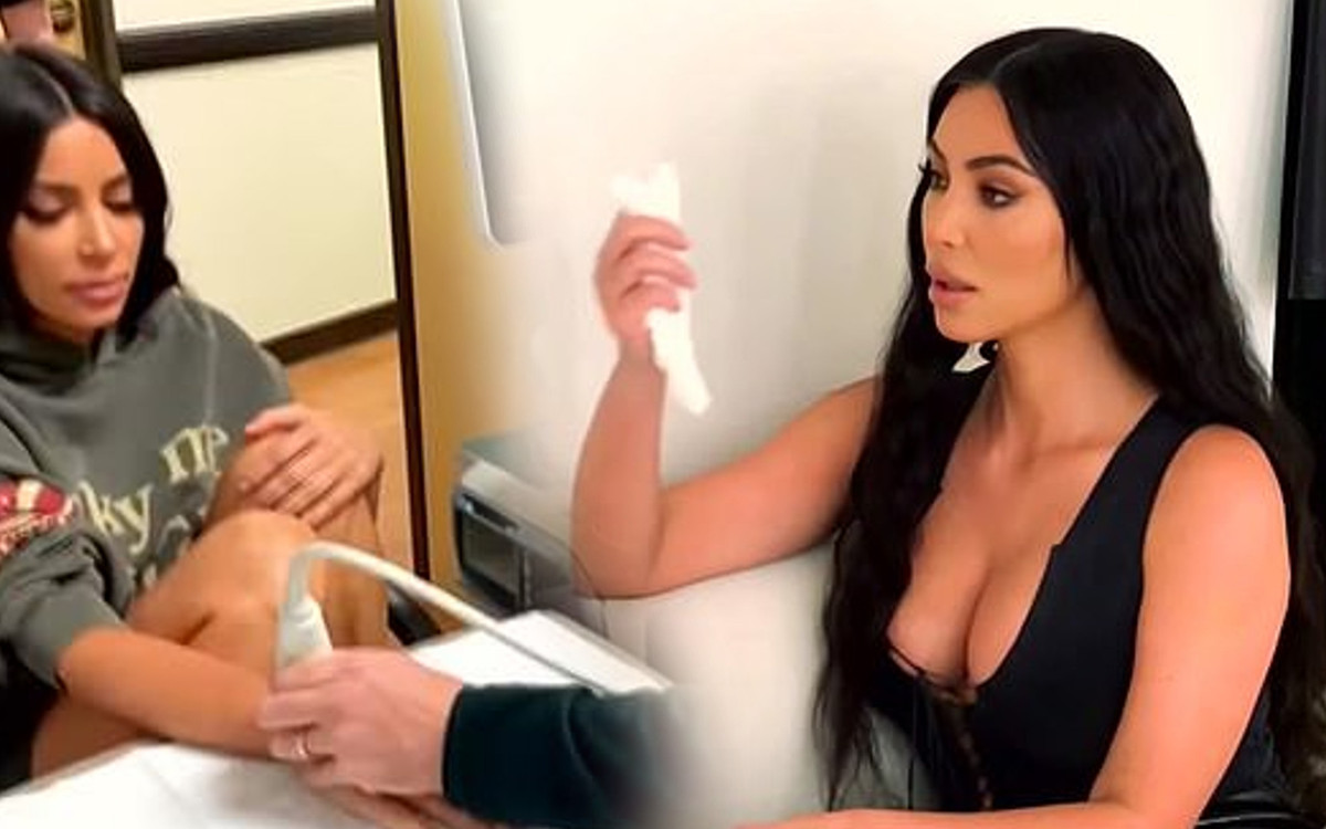 Kim Kardashian boi się, że cierpi na bardzo ciężką chorobę – łuszczyca to nie koniec zmartwień celebrytki?