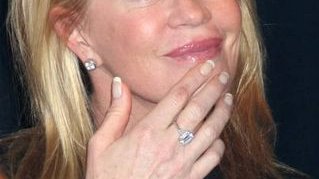 Melanie Griffith ma raka skóry?