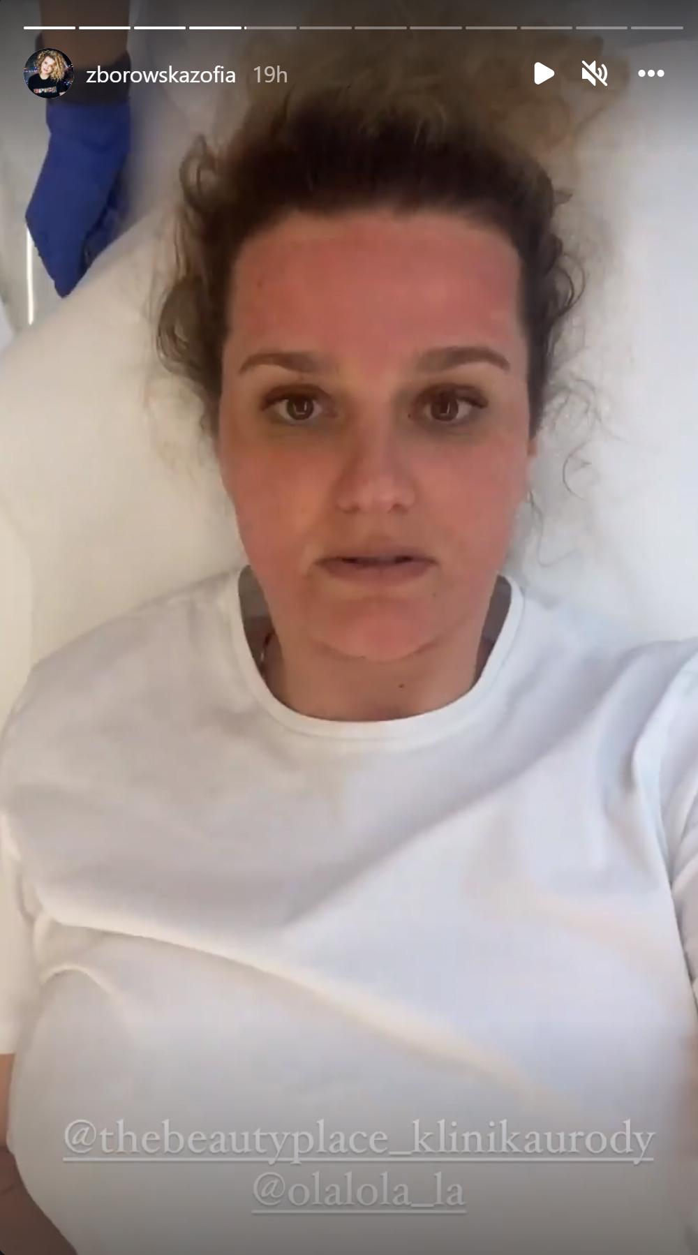 Zofia Zborowska zrobiła zabieg na twarz i ŻAŁUJE