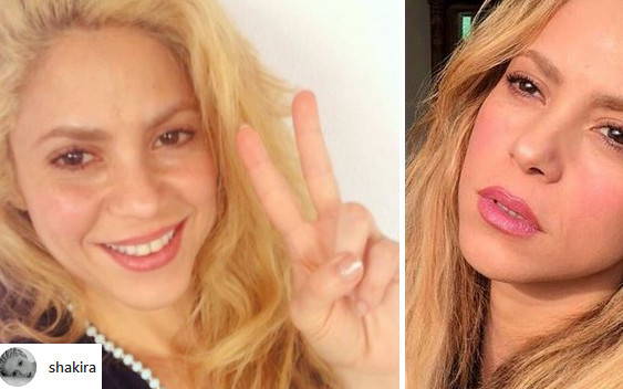 KOSZMAR! Shakira STRACI swoje piękne włosy?