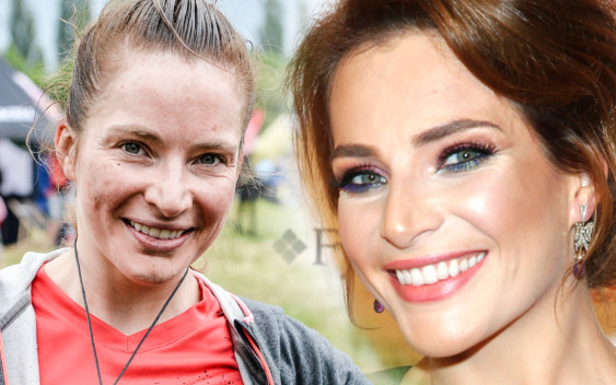 Anna Dereszowska pokazała twarz całą w PIEGACH (ZDJĘCIA)