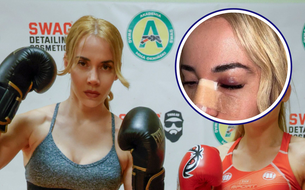 Marianna Schreiber pokazała zdjęcia po operacji nosa!