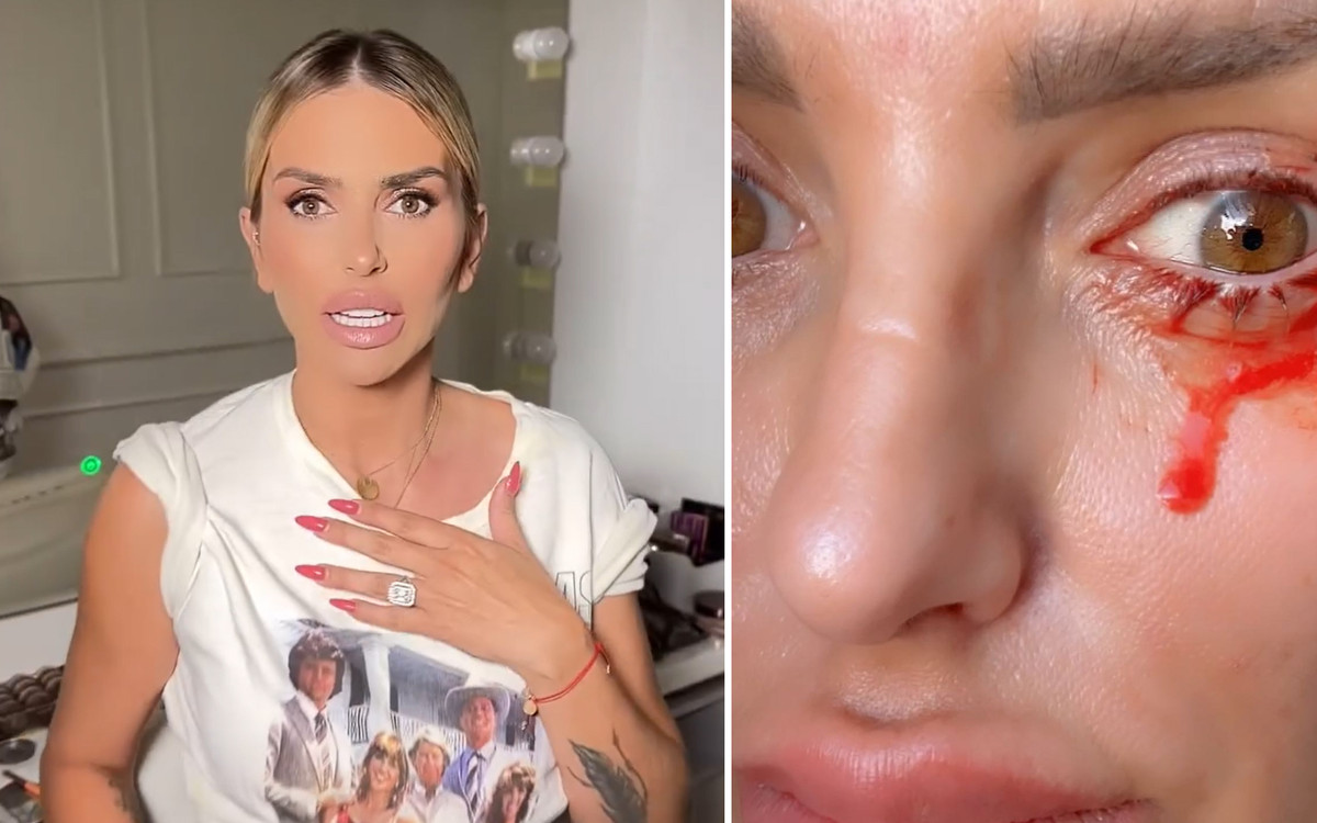 Monika Goździalska wraca do pobicia w samolocie! “Nadal słabo widzę”