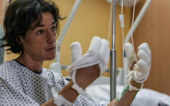 Revol miała halucynacje. Grozi jej przez to amputacja nogi!