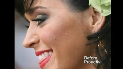 Katy Perry reklamuje preparat przeciwko trądzikowi [VIDEO]