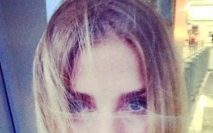 Kolejna gwiazda pokazuje, że cellulit dotyka też sławnych