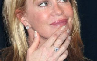 Melanie Griffith ma raka skóry?