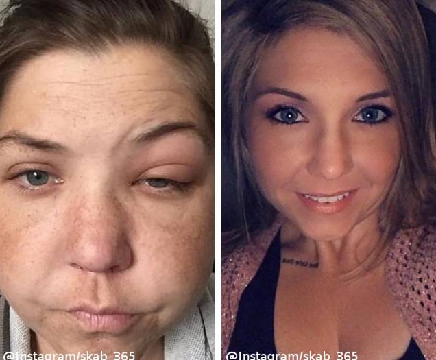 Przestali PIĆ i pokazali zdjęcia przed i po! Ich przemiana SZOKUJE!