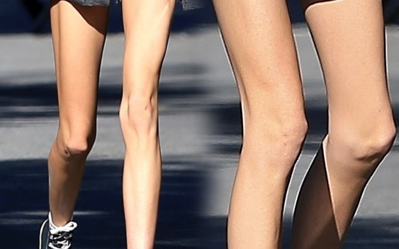 To nie jest Anja Rubik, choć nogi ma tak samo chude (ZDJĘCIA)