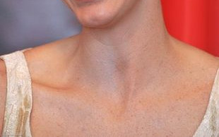 Nieszczęśliwa księżniczka będzie miała bliźniaki!