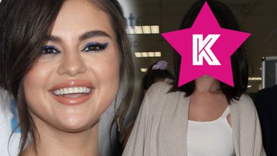 Ile zaskórników! Twarz Seleny Gomez jest w nie najlepszym stanie (ZDJĘCIA)