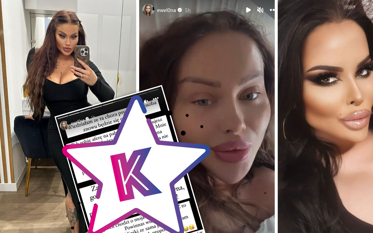 Ewel0na chwali się kolejną operacją i uderza w Esmeraldę Godlewską: “Promujesz klinikę, która ZABIJA ludzi”