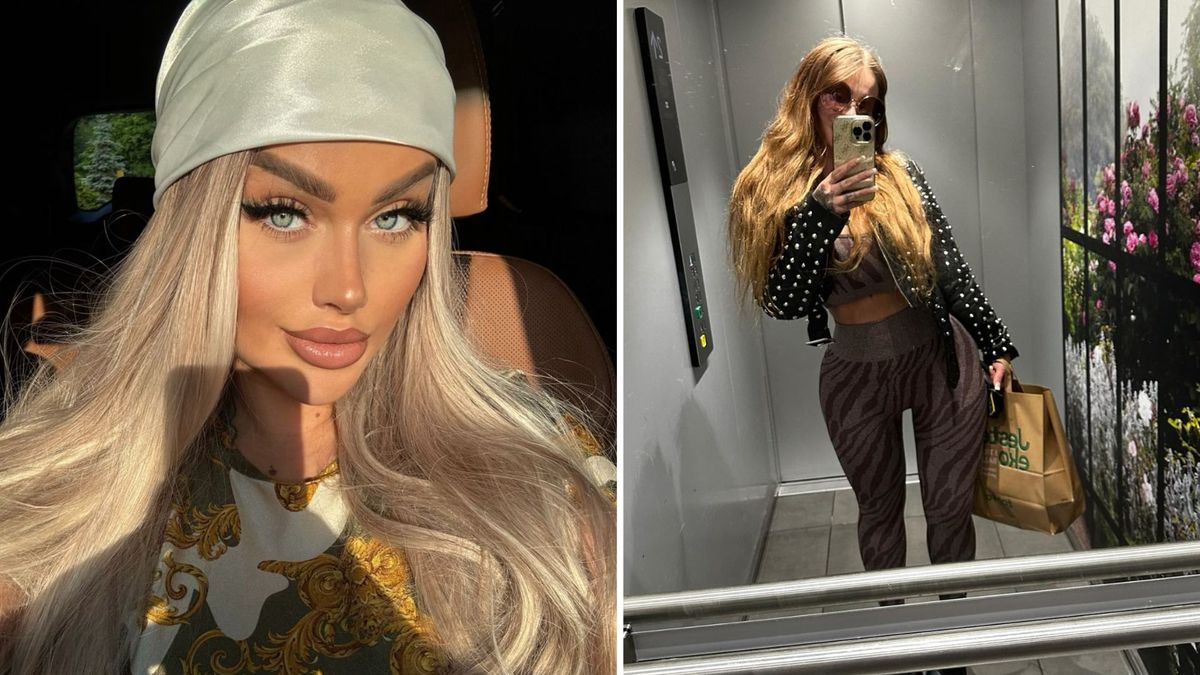 Ewel0na ponownie poddała się operacji! Tym razem zdecydowała się na LIPOSUKCJĘ