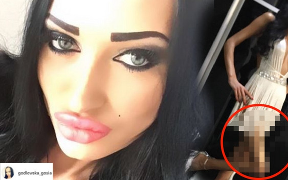 CO się stało z NOGĄ Godlewskiej?! Internauci myślą, że to PROTEZA