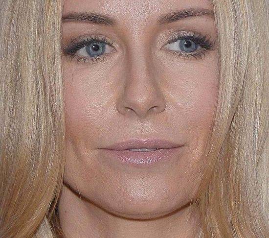 10 zaskakujących zbliżeń na twarz Małgorzaty Rozenek