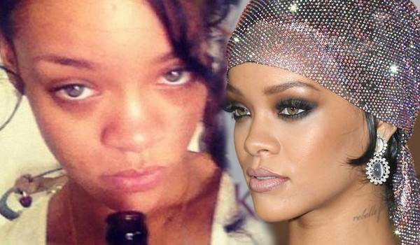 Te gwiazdy borykają się z trądzikiem