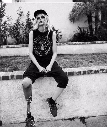 Modelka straciła nogę przez TAMPONY. Podzieliła się SZOKUJĄCYMI szczegółami