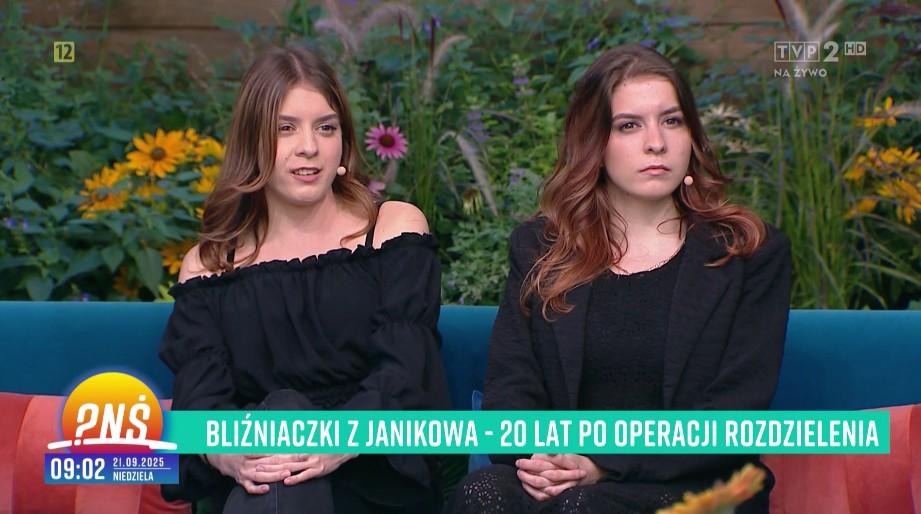 Tak dziś wyglądają polskie bliźnięta syjamskie, fot. TVP