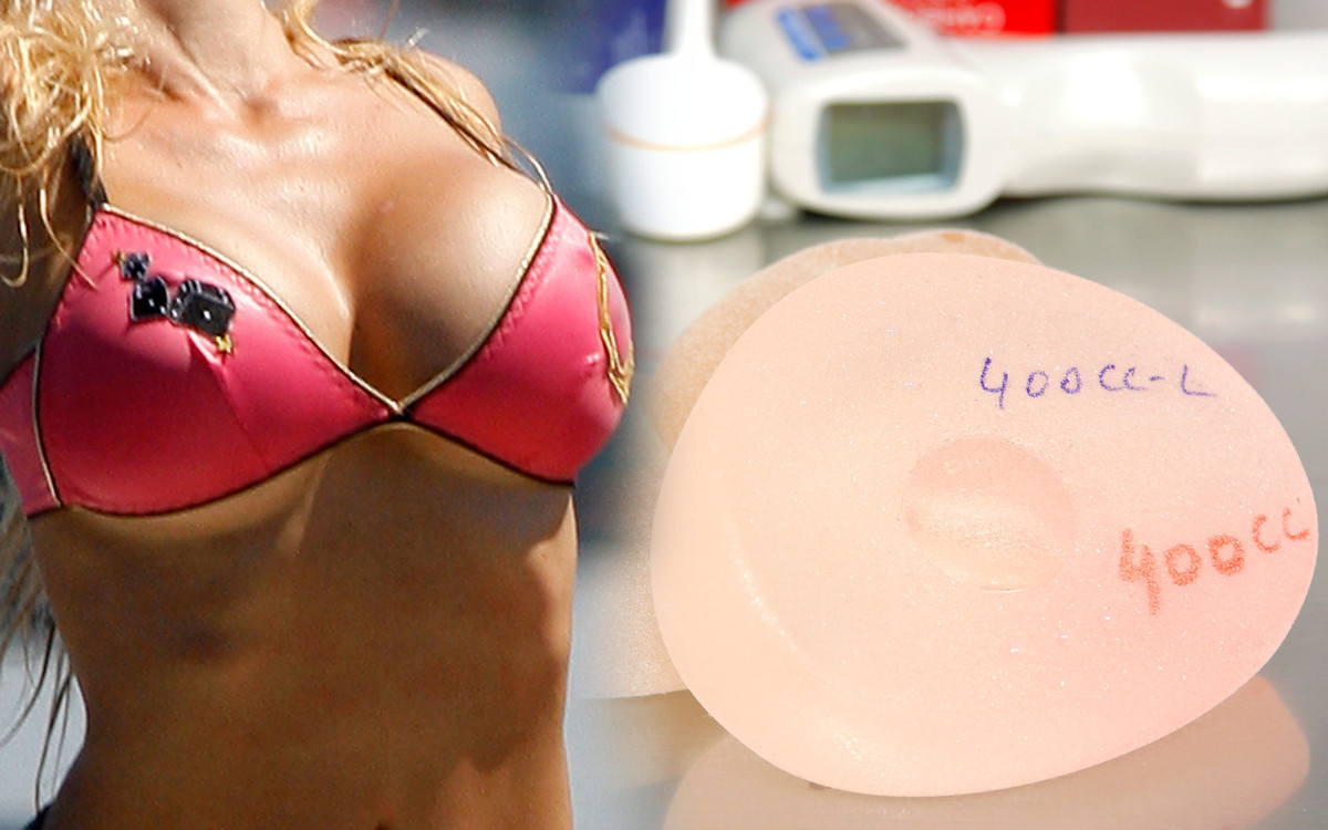 Naukowcy twierdzą, że silikonowe implanty piersi zwiększają ryzyko raka