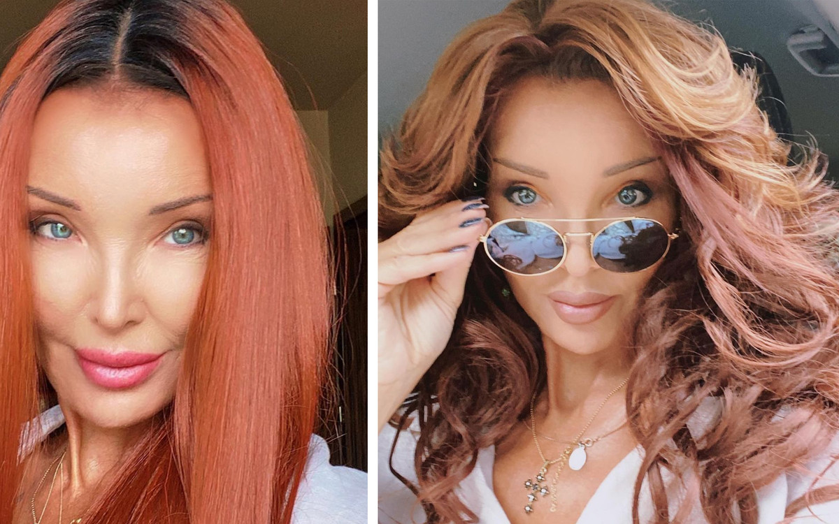 Ewa Minge zmaga się z silną reakcją alergiczną. Pokazała jak teraz wygląda. “Nie samym pięknem człowiek żyje”