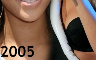 Czy Rihanna operowała sobie nos? (FOTO)