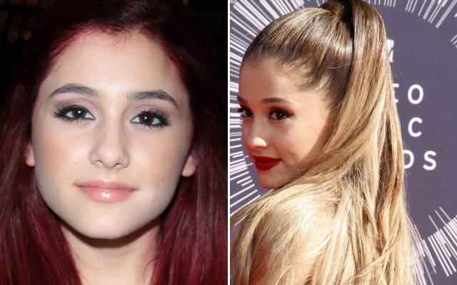 Jak pieniądze zmieniły twarze gwiazd?