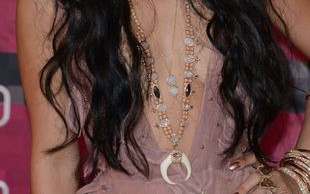 Z okazji MTV VMA przystroiła nawet gips (FOTO)