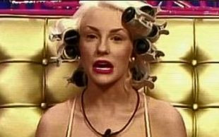 Spuchnięte i purpurowe piersi Courtney Stodden (FOTO)