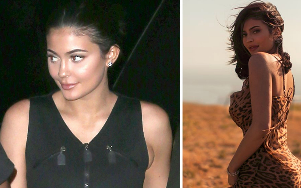 Znamy PRAWDZIWY powód, przez który Kylie Jenner usunęła wypełniacze z ust!